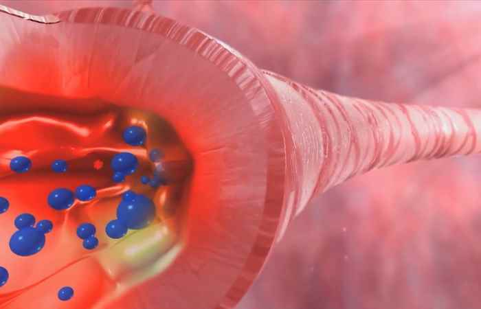 Sống khỏe 360 -  Viêm phổi ở trẻ em (16-01-2020)